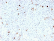 IHC staining of FFPE human tonsil with recombinant IgM antibody (clone rIM260). HIER: boil tissue sections in pH 9 10mM Tris with 1mM EDTA for 10-20 min and allow to cool before testing.