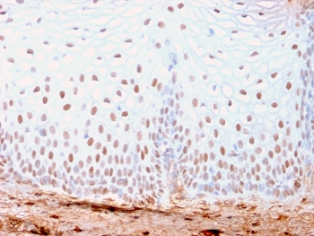 IHC staining of FFPE human skin with recombinant SOX2 antibody (clone SOX2/3169R). HIER: boil tissue sections in pH 9 10mM Tris with 1mM EDTA for 10-20 min and allow to cool before testing.~