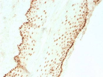 IHC staining of FFPE human cervi