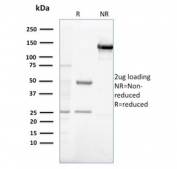 SDS-PAGE analysis of purified, BSA-free Gastrin antibody (clone GAST/2632) as confirmation of integrity and purity.