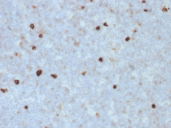 IHC staining of FFPE human tonsil with IgM Heavy Chain antibody (clone R1/69). HIER: boil tissue sections in pH 9 10mM Tris with 1mM EDTA for 10-20 min and allow to cool before testing.~