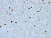 IHC staining of FFPE human tonsil with IgM Heavy Chain antibody (clone R1/69). HIER: boil tissue sections in pH 9 10mM Tris with 1mM EDTA for 10-20 min and allow to cool before testing.