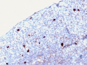 IHC staining of FFPE human tonsil with recombinant IgM Heavy Chain antibody (clone rIGHM/2558). HIER: boil tissue sections in pH 9 10mM Tris with 1mM EDTA for 10-20 min and allow to cool before testing.