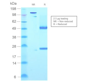 SDS-PAGE analysis of purified, BSA-free recombinant IgM Heavy Chain antibody (clone rIGHM/2558) as confirmation of integrity and purity.