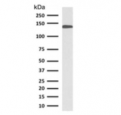 Western blot testing of human small intestine lysate with Cadherin 17 antibody (clone CDN17-1). Expected molecular weight ~120 kDa.