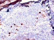IHC staining of FFPE human tonsil with recombinant IgM antibody (clone IGHM/2557R). HIER: boil tissue sections in pH 9 10mM Tris with 1mM EDTA for 10-20 min and allow to cool before testing.