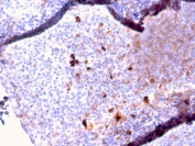 IHC staining of FFPE human tonsil with recombinant IgM antibody (clone IGHM/2557R). HIER: boil tissue sections in pH 9 10mM Tris with 1mM EDTA for 10-20 min and allow to cool before testing.