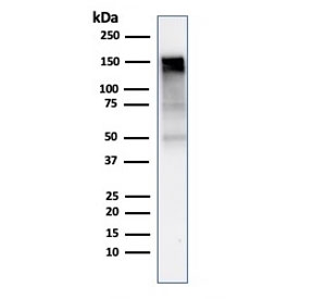 Western blot testing of human A431 cell lysate with EGFR antibody (clone rGFR/1667). Expected molecular weight: ~134/170 kDa (unmodified/glycosylated).~