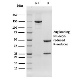 SDS-PAGE analysis of purified, BSA-free EGFR antibody (clone rGFR/1667) as confirmat