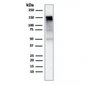 Western blot testing of human A431 cell lysate with EGFR antibody (clone rGFR/1667). Expected molecular weight: ~134/170 kDa (unmodified/glycosylated).