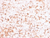 IHC staining of FFPE human tonsil with recombinant Lambda Light Chain antibody (clone rLLC/3777). HIER: boil tissue sections in pH 9 10mM Tris with 1mM EDTA for 20 min and allow to cool before testing.