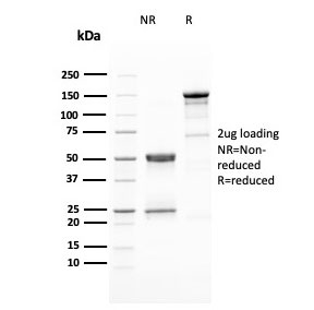 SDS-PAGE analysis of purified, BSA-free HER-2 antibody (clone ERBB2/3080) as confirmation of integrity and purity.