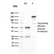 SDS-PAGE analysis of purified, BSA-free HER-2 antibody (clone ERBB2/3080) as confirmation of integrity and purity.