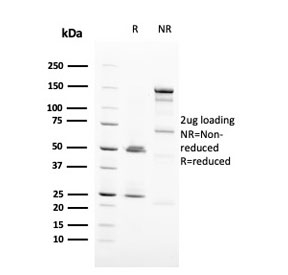 SDS-PAGE analysis of purified, BSA-free HER-2 antibody (clone ERBB2/3093) as confirmation of integrity and purity.