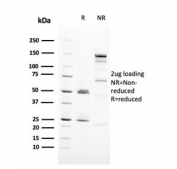 SDS-PAGE analysis of purified, BSA-free HER-2 antibody (clone ERBB2/3093) as confirmation of integrity and purity.