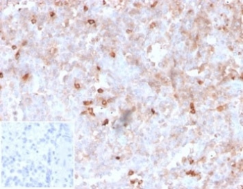 IHC staining of FFPE human spleen with recombinant Lambda Light Chain antibody (clone rLLC/1738). Negative control inset: PBS used instead of primary antibody to control for secondary Ab binding. HIER: boil tissue sections in pH 9 10mM Tris with 1mM EDTA for 20 min and allow to cool before testing.