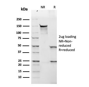 SDS-PAGE analysis of purified, BSA-free recombinant Lambda Light Chain antibody (clone rLLC/1738) as confirmation of integrity and purity.