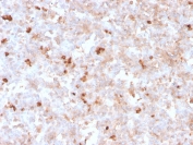 IHC staining of FFPE human spleen with recombinant Lambda Light Chain antibody (clone rLLC/1738). HIER: boil tissue sections in pH 9 10mM Tris with 1mM EDTA for 20 min and allow to cool before testing.