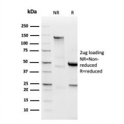 SDS-PAGE analysis of purified, BSA-free recombinant Lambda antibody (clone LLC/3778R) as confirmation of integrity and purity.