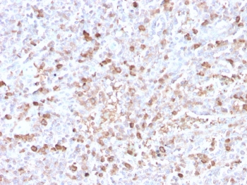 IHC staining of FFPE human spleen with recombinant Lambda antibody (clone LLC/3778R). HIER: boil tissue sections in pH 9 10mM Tris with 1mM EDTA for 20 min and allow to cool before testing.