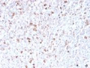IHC staining of FFPE human spleen with recombinant Lambda antibody (clone LLC/3778R). HIER: boil tissue sections in pH 9 10mM Tris with 1mM EDTA for 20 min and allow to cool before testing.