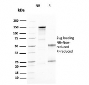 SDS-PAGE analysis of purified, BSA-free CD25 antibody (clone IL2RA/2394) as confirmation of integrity and purity.