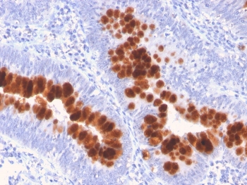 IHC staining of FFPE human colon with Fas antibody. HIER: boil tissue sections in pH 9 10mM Tris with 1mM EDTA for 20 min and allow to cool before testing.
