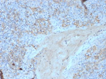 IHC staining of FFPE human tonsil with CD95 antibody. HIER: boil tissue sections in pH 9 10mM Tris with 1mM EDTA for 20 min and allow to cool before testing.~