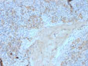 IHC staining of FFPE human tonsil with CD95 antibody (clone FAS/3588). HIER: boil tissue sections in pH 9 10mM Tris with 1mM EDTA for 20 min and allow to cool before testing.