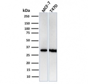 Western blot testing of human MCF7 and T47D cell lysate with recombinant RPA32 antibody. Expected molecular weight ~32 kDa.