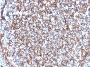 IHC staining of FFPE human tonsil with CD11b antibody (clone ITGAM/3340). HIER: boil tissue sections in pH 9 10mM Tris with 1mM EDTA for 20 min and allow to cool before testing.