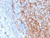 IHC staining of FFPE human tonsil with CD11b antibody (clone ITGAM/3337). HIER: boil tissue sections in pH 9 10mM Tris with 1mM EDTA for 20 min and allow to cool before testing.
