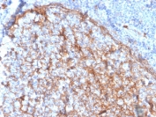 IHC staining of FFPE human tonsil with CD11b antibody (clone ITGAM/3337). HIER: boil tissue sections in pH 9 10mM Tris with 1mM EDTA for 20 min and allow to cool before testing.