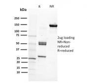 SDS-PAGE analysis of purified, BSA-free CD29 antibody (clone 12G10) as confirmation of integrity and purity.