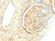 IHC testing of FFPE human kidney with ITGB3 antibody (clone ITGB3/2145). Required HIER: boil tissue sections in 10mM Tris with 1mM EDTA, pH9, for 10-20 min followed by cooling at RT for 20 min.
