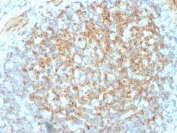 IHC testing of FFPE human tonsil with ITGB3 antibody (clone ITGB3/2145). Required HIER: boil tissue sections in 10mM Tris with 1mM EDTA, pH9, for 10-20 min followed by cooling at RT for 20 min.