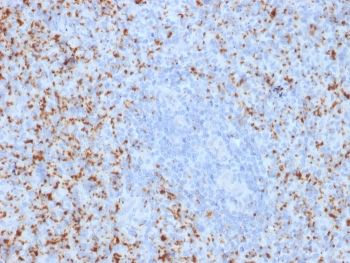 IHC testing of FFPE human spleen with ITGB3 antibody. Required HIER: boil tissue sections in 10mM Tris with 1mM EDTA, pH9, for 10-20 min followed by cooling at RT for 20 min.