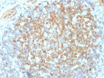 IHC testing of FFPE human tonsil with ITGB3 antibody. Required HIER: boil tissue sections in 10mM Tris with 1mM EDTA, pH9, for 10-20 min followed by cooling at RT for 20 min.