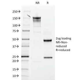 SDS-PAGE analysis of purified, BSA-free ITGB3 antibody as confirmation of integrity and purity.