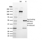 SDS-PAGE analysis of purified, BSA-free ITGB3 antibody (clone ITGB3/2597) as confirmation of integrity and purity.