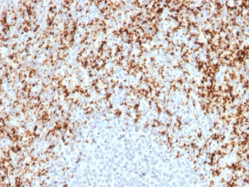 IHC testing of FFPE human spleen with ITGB3 antibody. Required HIER: boil tissue sections in 10mM Tris with 1mM EDTA, pH9, for 10-20 min followed by cooling at RT for 20 min.~
