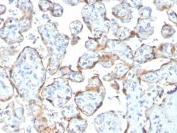 IHC staining of FFPE human placenta with recombinant TIMP2 antibody (clone rTIMP2/2335). Required HIER: requires boil tissue sections in pH 9 10mM Tris with 1mM EDTA for 10-20 min and allow to cool before testing.