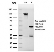 SDS-PAGE analysis of purified, BSA-free recombinant Involucrin antibody (clone rIVRN/827) as confirmation of integrity and purity.