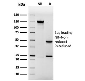 SDS-PAGE analysis of purified, BSA-free rec
