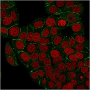 Immunofluorescent staining of PFA-fixed human MCF7 cells with recombinant Plakoglobin antibody (clone rCTNG/1664, green) and Reddot nuclear stain (red).