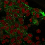 Immunofluorescent staining of PFA-fixed human HepG2 cells with recombinant Plakoglobin antibody (clone rCTNG/1664, green) and Reddot nuclear stain (red).