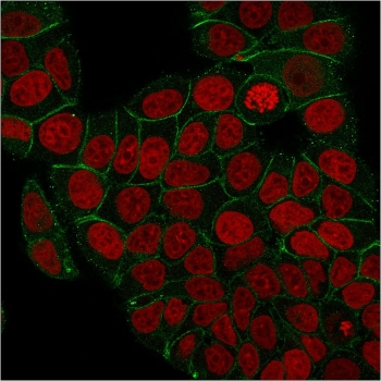 Immunofluorescent staining of PFA-fixed human MCF7 cells with recombinant Plakoglobin antibody (clone rCTNG/1664, green) and Reddot nuclear stain (red).
