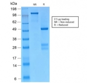 SDS-PAGE analysis of purified, BSA-free recombinant Catenin gamma antibody (clone CTNG/2155R) as confirmation of integrity and purity.