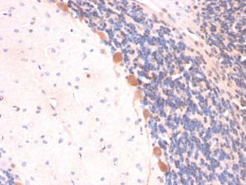 IHC staining of FFPE rat brain with ARF1 antibody (clone ARF1/2117). HIER: boil tissue sections in pH 9 10mM Tris with 1mM EDTA for 20 min and allow to cool before testing.