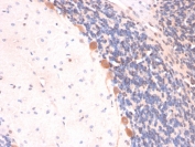 IHC staining of FFPE rat brain with ARF1 antibody (clone ARF1/2117). HIER: boil tissue sections in pH 9 10mM Tris with 1mM EDTA for 20 min and allow to cool before testing.